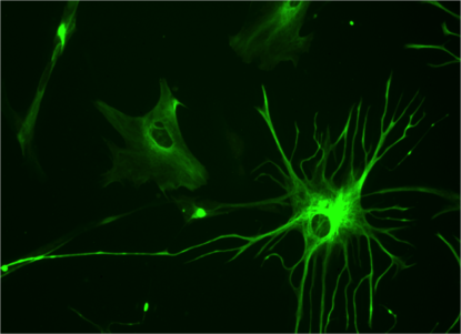 neurons2-415x301