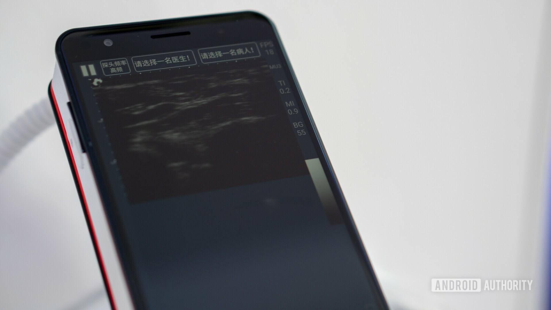 The unusual CloudMinds XI - ultrasound test at MWC 2019