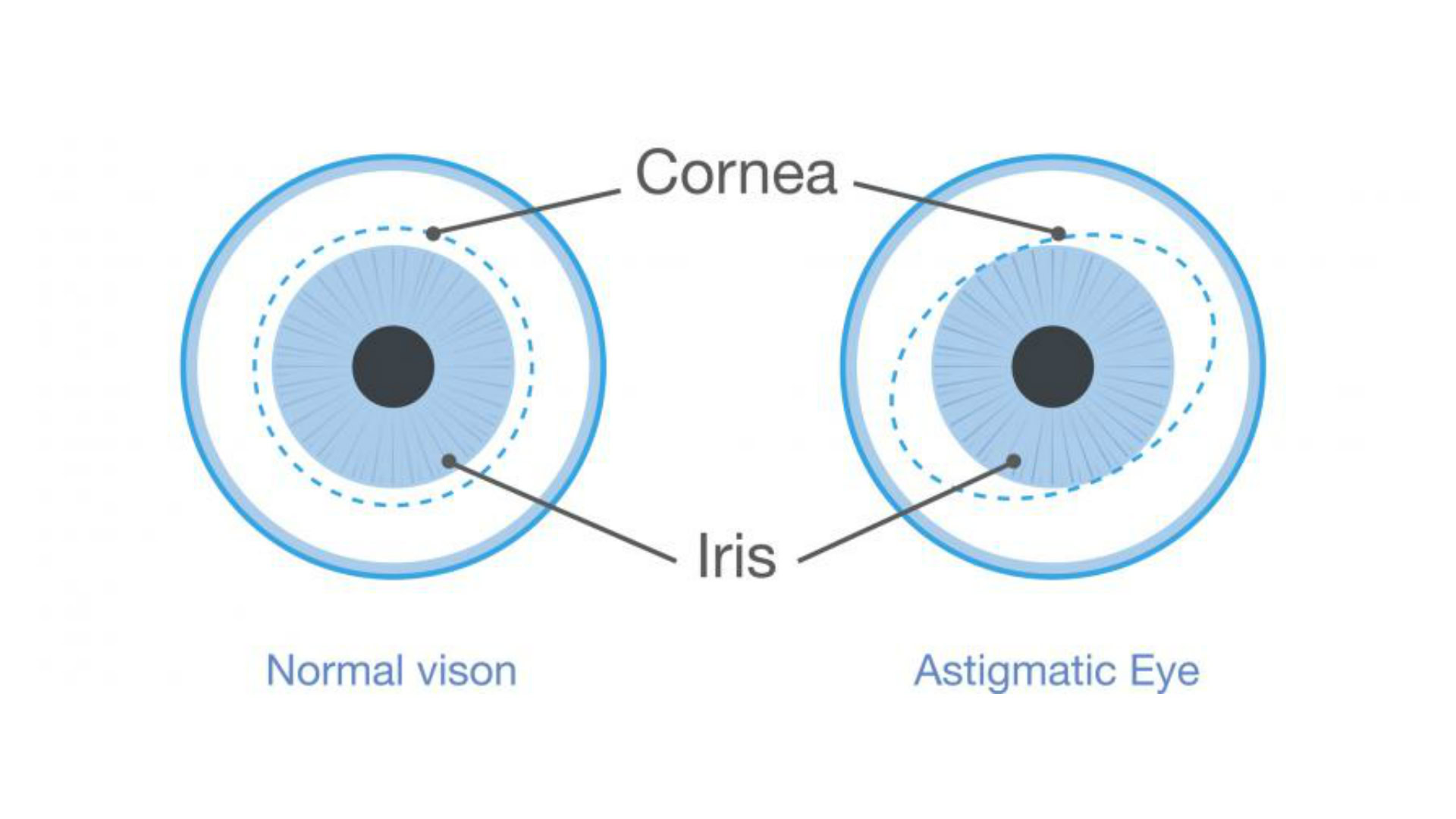 Does light mode damage eyes?