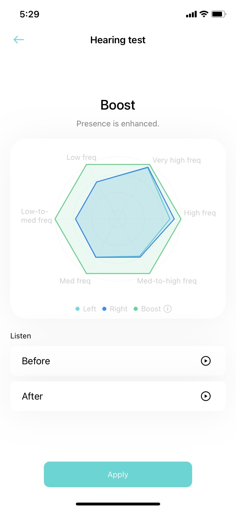 OnePlus Buds Pro hearing test results displayed in chart.