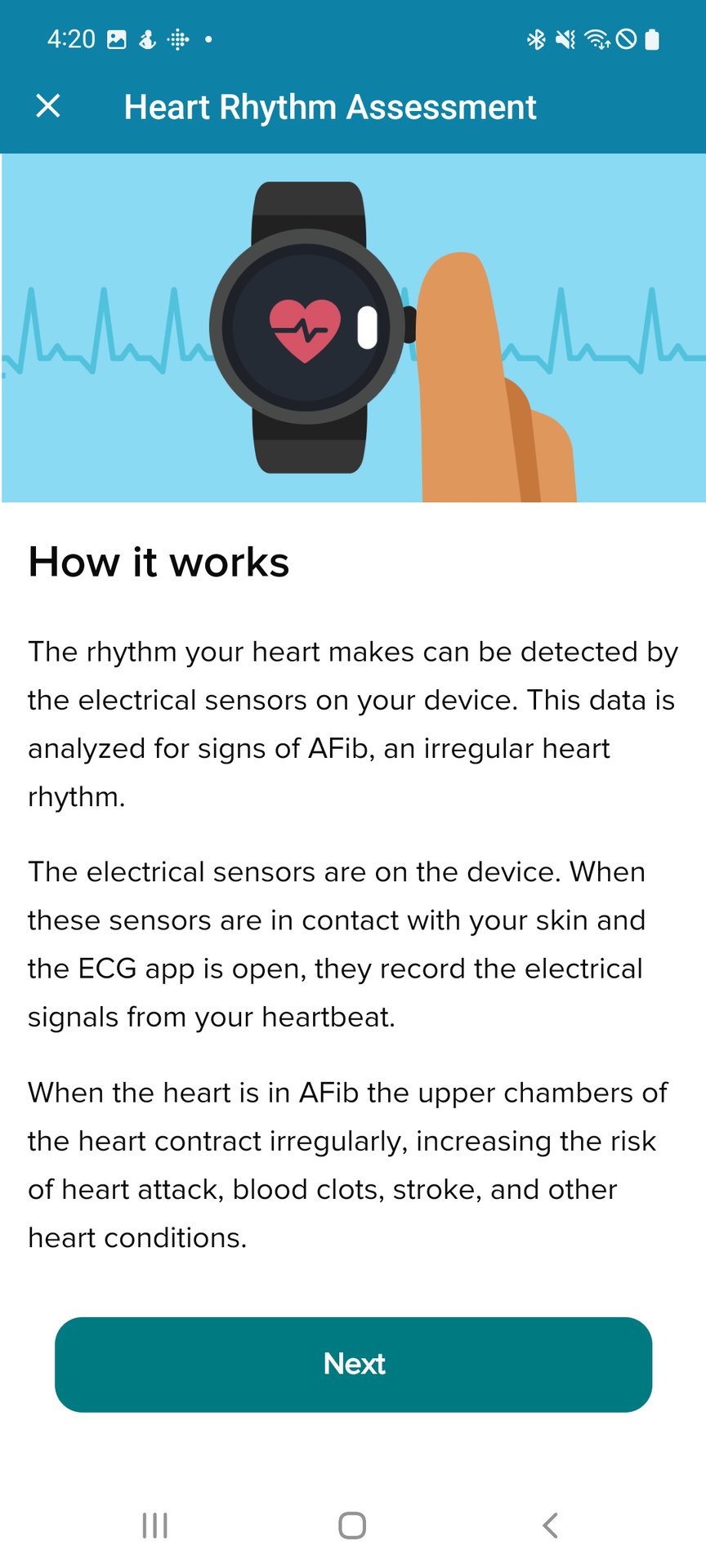 Fitbit App ECG How To