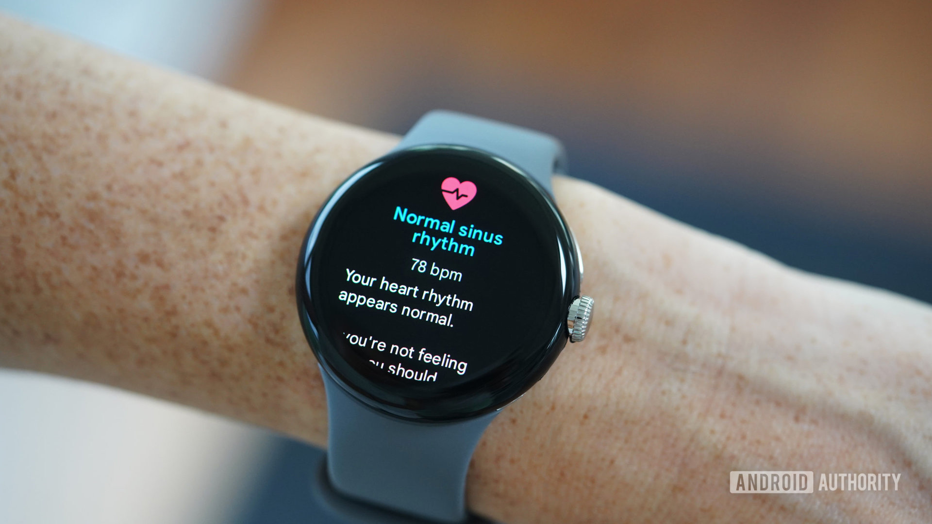 A Google Pixel Watch displays a user's ECG results.