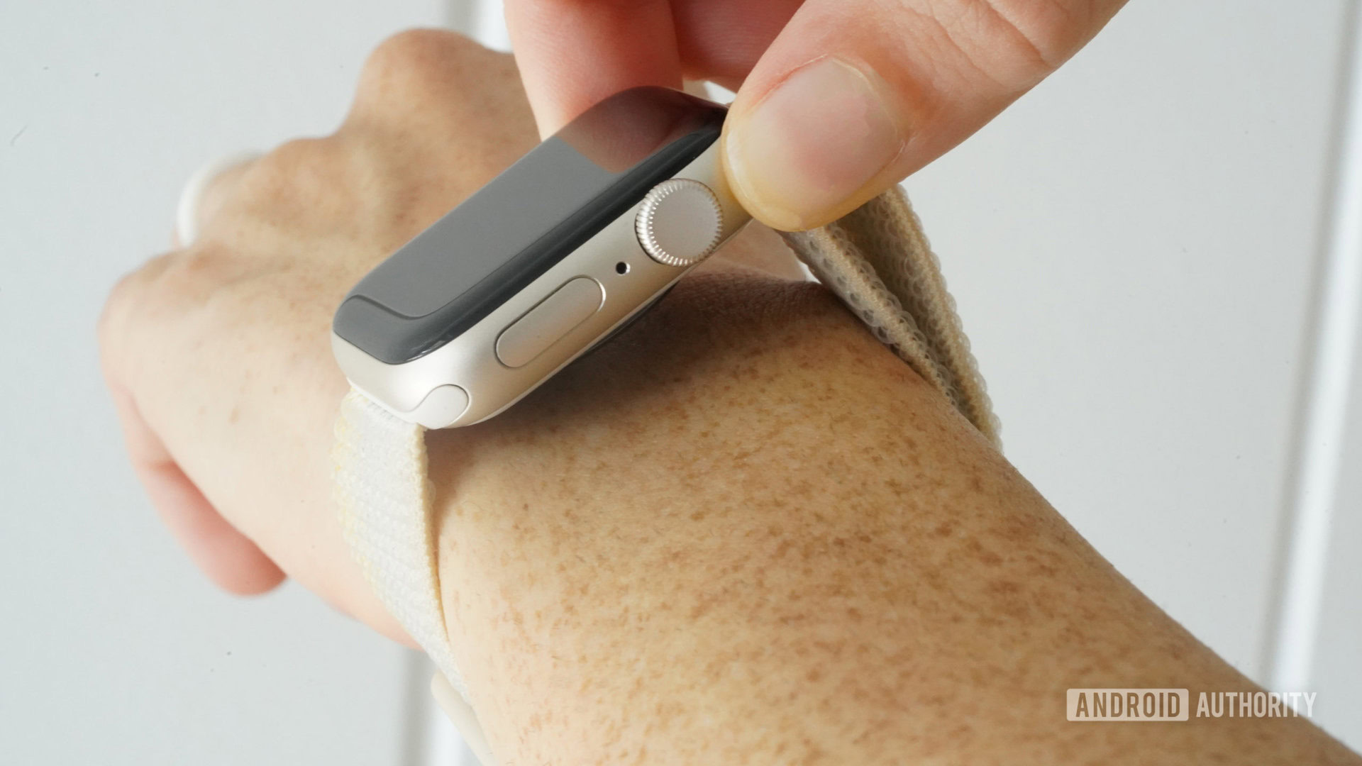 How To Avoid Rashes And Skin Irritation From Your Apple Watch