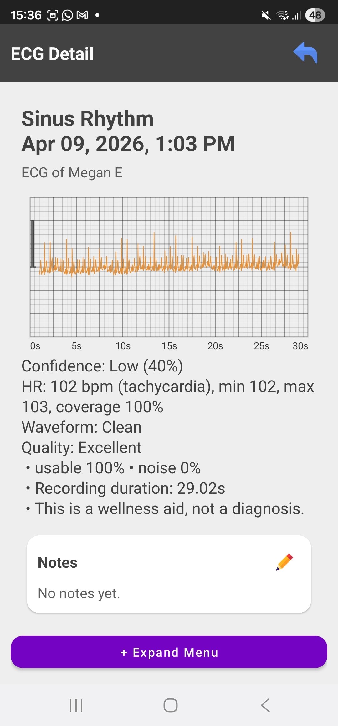geminiman wellness companion sinus rhythm measurement